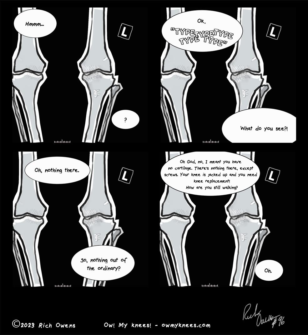 Knee Check